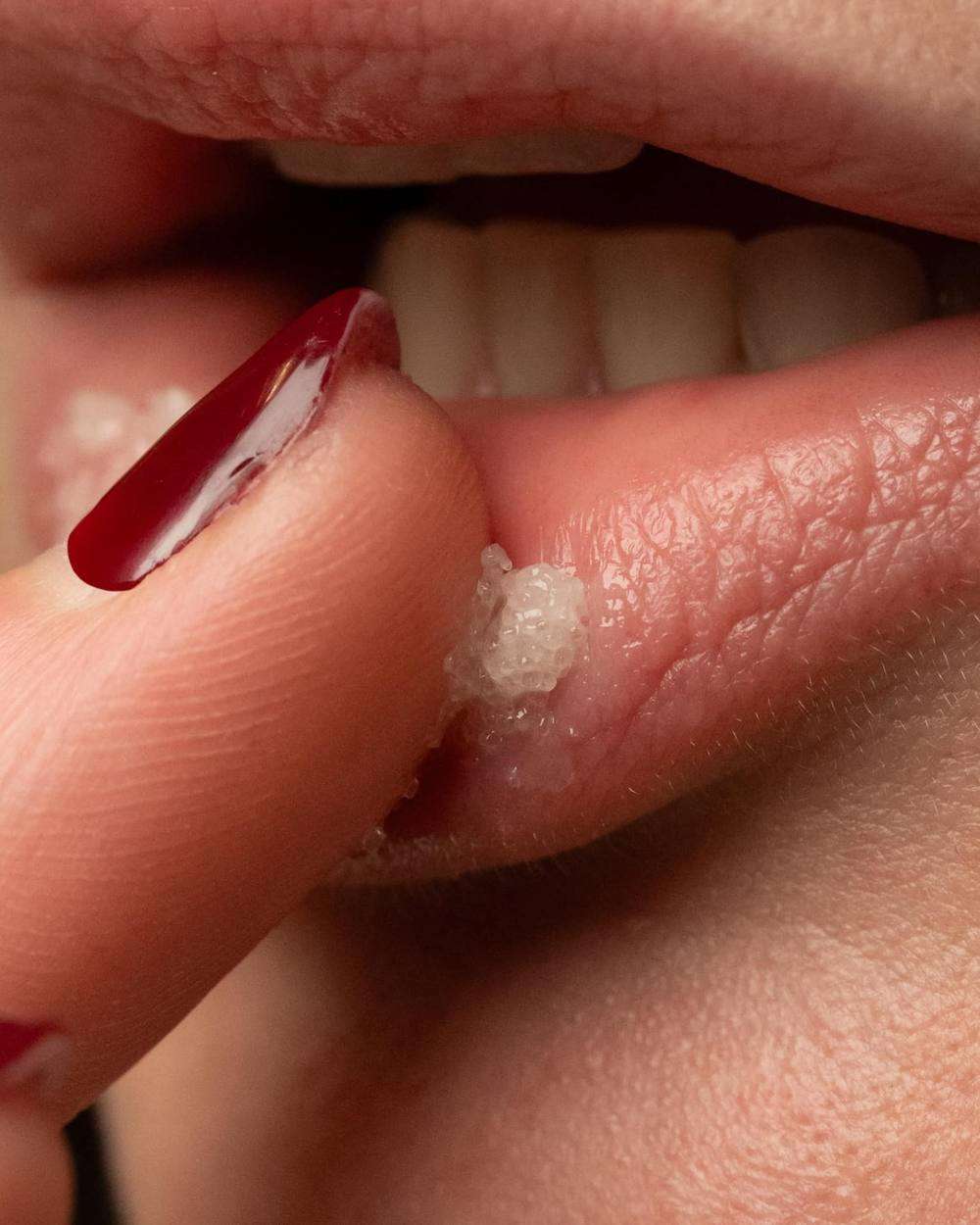 Scrub Lip Trew